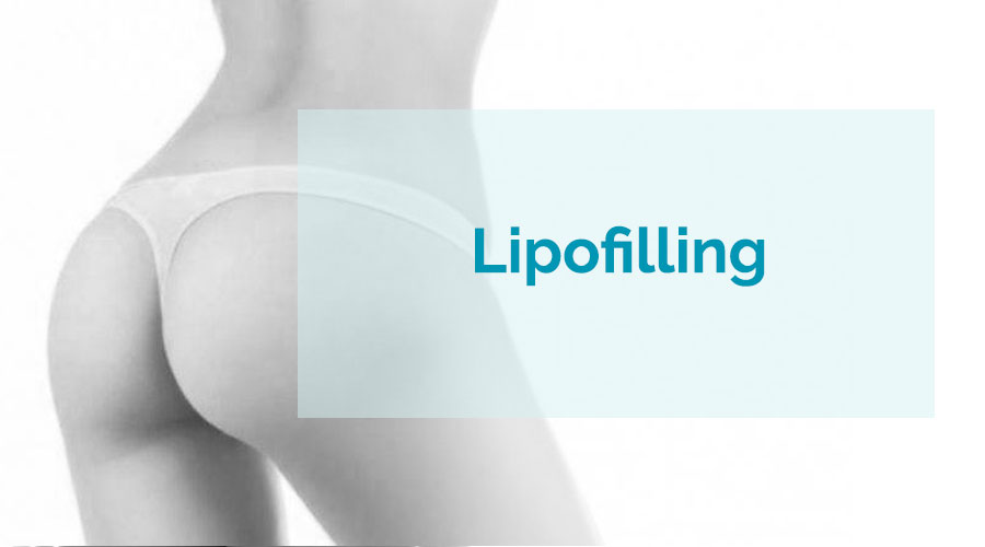 Lipofilling (Rellenos de grasa)