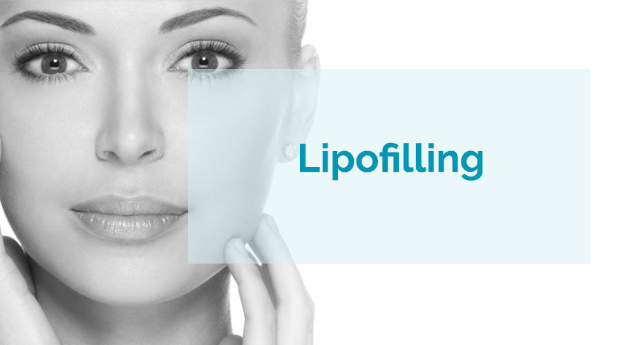 Lipofilling (injertos de grasa)